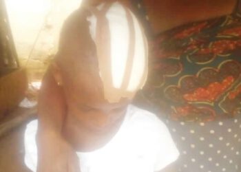 Child Brutality: Woman Hits Nine-year-old Housemaid With Hot Iron On Her Head, Says She’s Stubborn