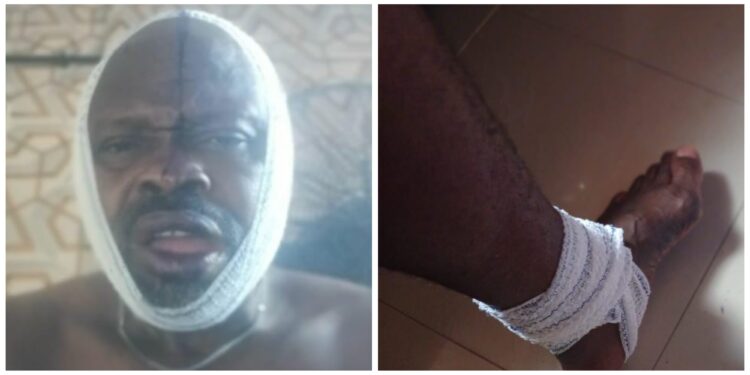Man Brutalised, Forced Out of Lagos Community Over Alleged Same-Sex Relationship