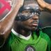 Osimhen Ruled Out of Nigeria’s AFCON Qualifiers Against Madagascar, Guinea-Bissau
